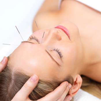 Acupunture therapy
