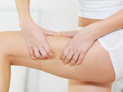 Cellulite Are Hormonal Changes The Major Factor