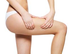 Get to Know These Rules before You Treat Your Cellulite