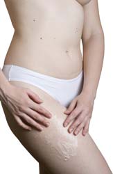 Cellulite Lotions