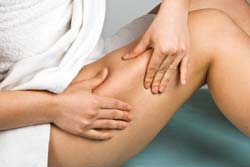 Cellulite Stages of Development Cellulite Stages of Development