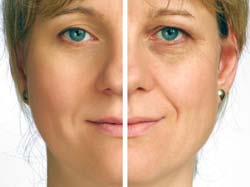 Eye Cream Dark Circle