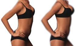 Perfect Curves Before and After