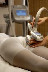 Treat Cellulite Through Endermologie