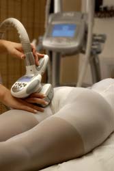 Use UltraShape to Reduce Your Cellulite