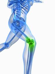 Flexoplex - arthritis pain relief cream