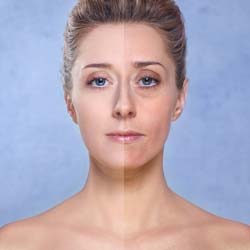 Best Anti-aging Creams