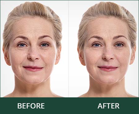 Stemuderm-before-and-after-photo Stemuderm-before-and-after-photo