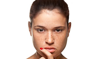 Can Lemon Really Help to Lighten Your Skin?