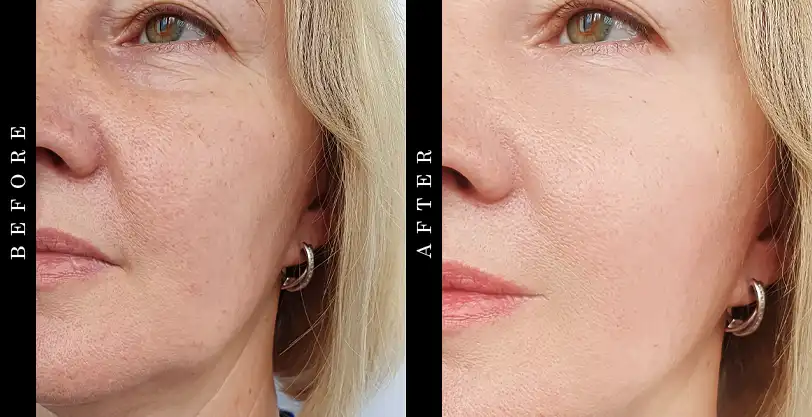 ActivatedYou Essential Skin Food Before and After