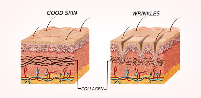 benefits-of-best-wrinkle-creams