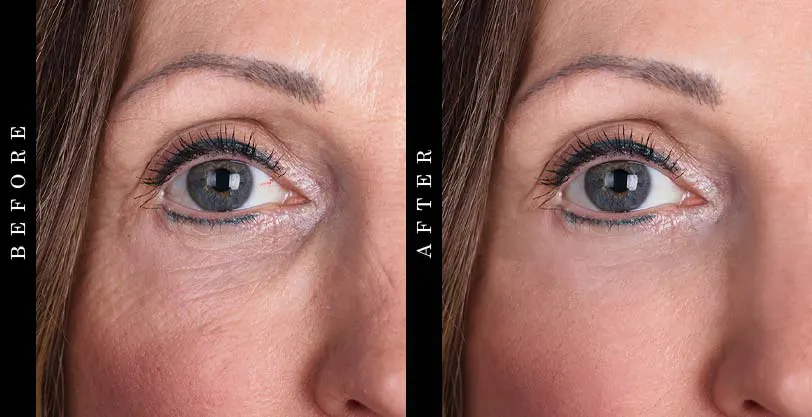 best-anti-aging-cream-before-after