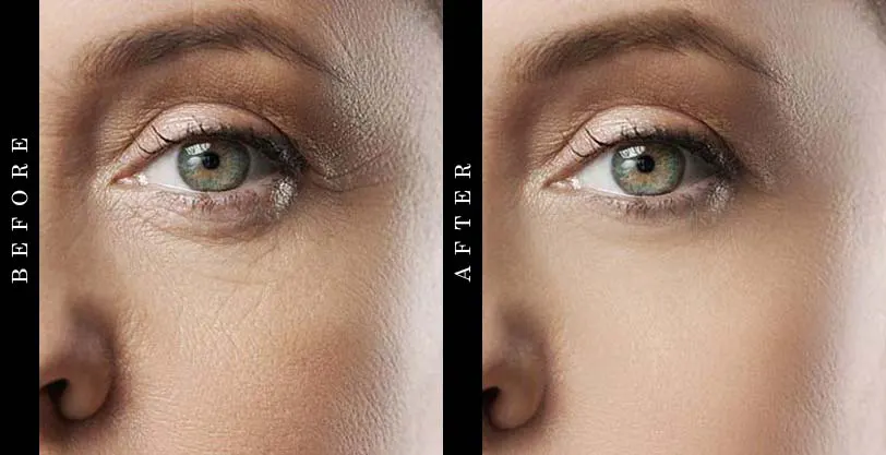 best-wrinkle-cream-before-after