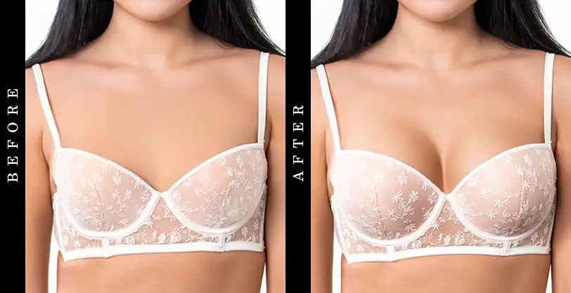 breast-enhancement-before-after