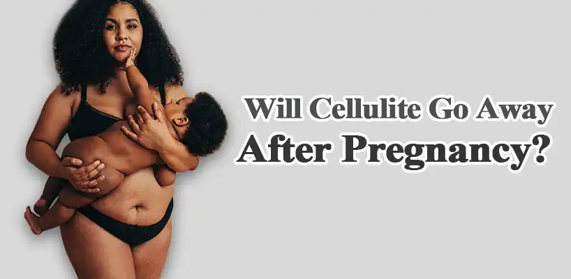 Will Cellulite Go Away After Pregnancy?