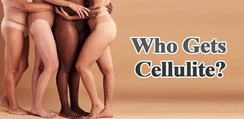 cellulite-creams