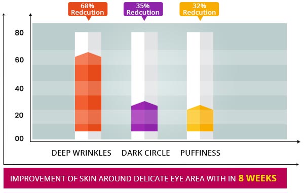 eyevge before and after