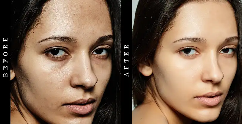 face-exfoliator-before-after