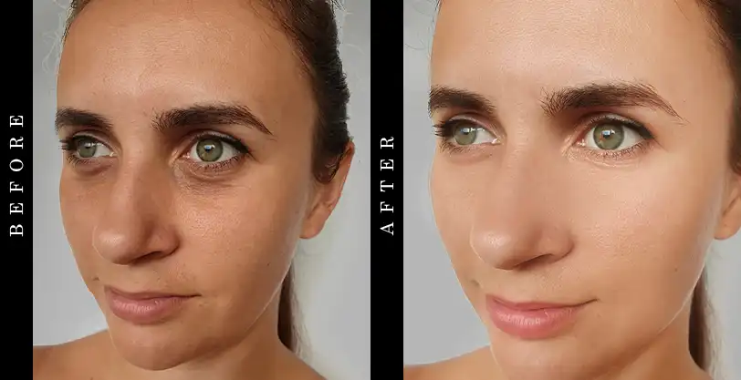 face-serum-before after