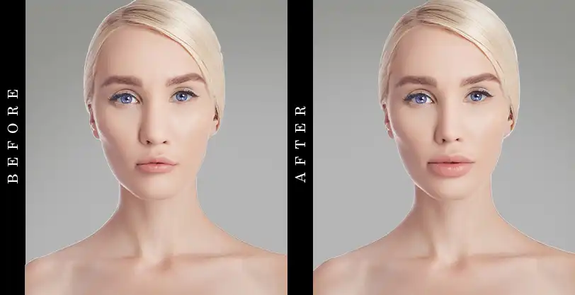 Best Lip Plumper Before and after Effects