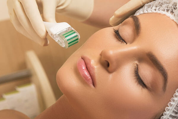 Microneedling To Smooth Depressed Acne Scars
