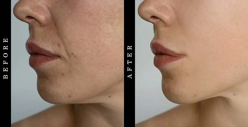 moisturizer-before-after