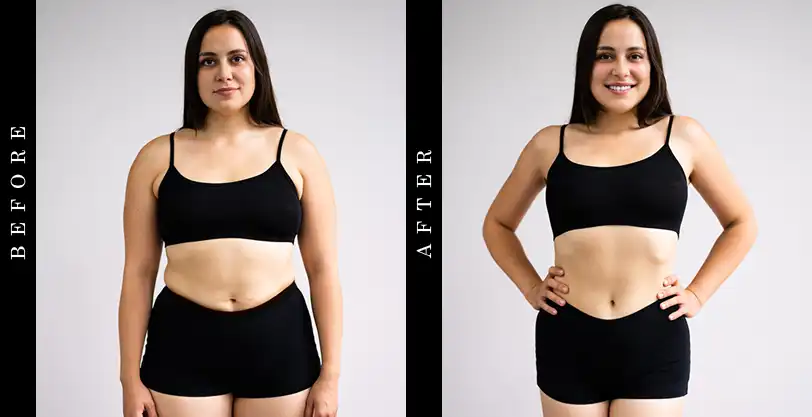 Multi-GI 5 Before and After